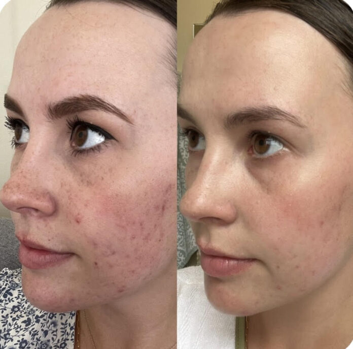 The Art of Facial Aesthetics at Eternia Medspa